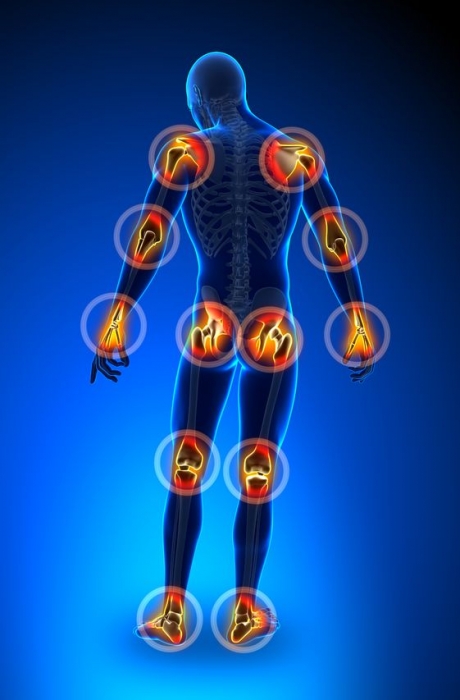 bursitis-tendinitis (1)